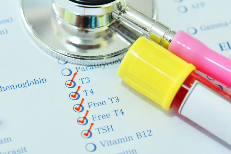 Choroba Hashimoto Obalamy 8 Mitow Na Temat Tego Schorzenia