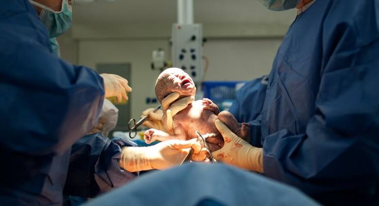 Zadośćuczynienia za błędy przy porodzie zasądzane są w Polsce w coraz wyższych kwotach. Procesy wciąż jednak trwają latami.