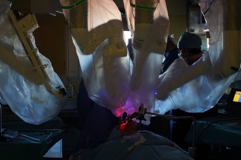 W Polsce operacje za pomocą robota da Vinci przeprowadzane były m.in. w Wielkopolskim Centrum Onkologii.
