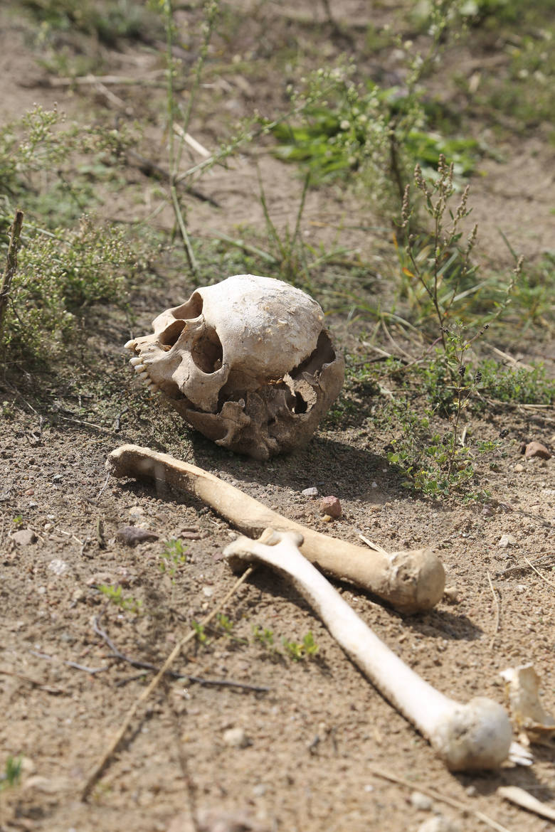 Czaszka i kości - ludzkie szczątki leżą tuż przy ścieżce, którą spacerują mieszkańcy. Podobno bawią się nimi dzieci. 