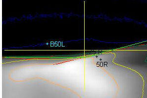 Rys.7. Widok jak rys.6. Wkreślony układ współrzędnych, nominalne położenie GSC zgrane z wyznaczoną GSC. Punkty charakterystyczne 50R i 75 R są odległe