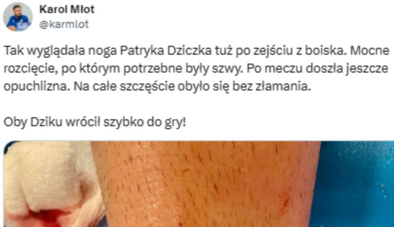 Kontuzjowana noga Patryka Dziczka.