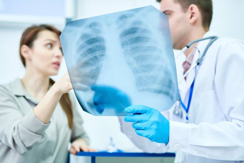 Zapalenie płuc to stan zapalny miąższu płuc, powodujący powstanie charakterystycznego wysięku