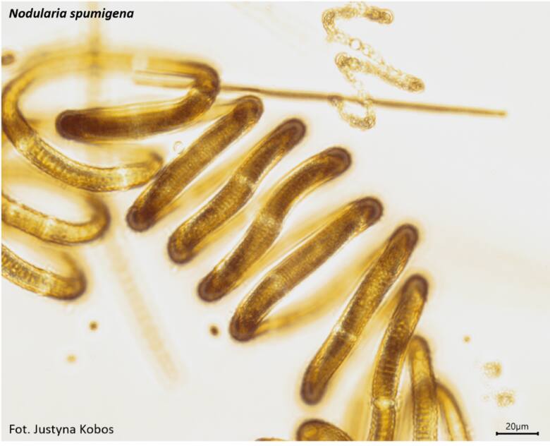 Tak wygląda sinica pod mikroskopem – gatunek Nodularia spumigena.