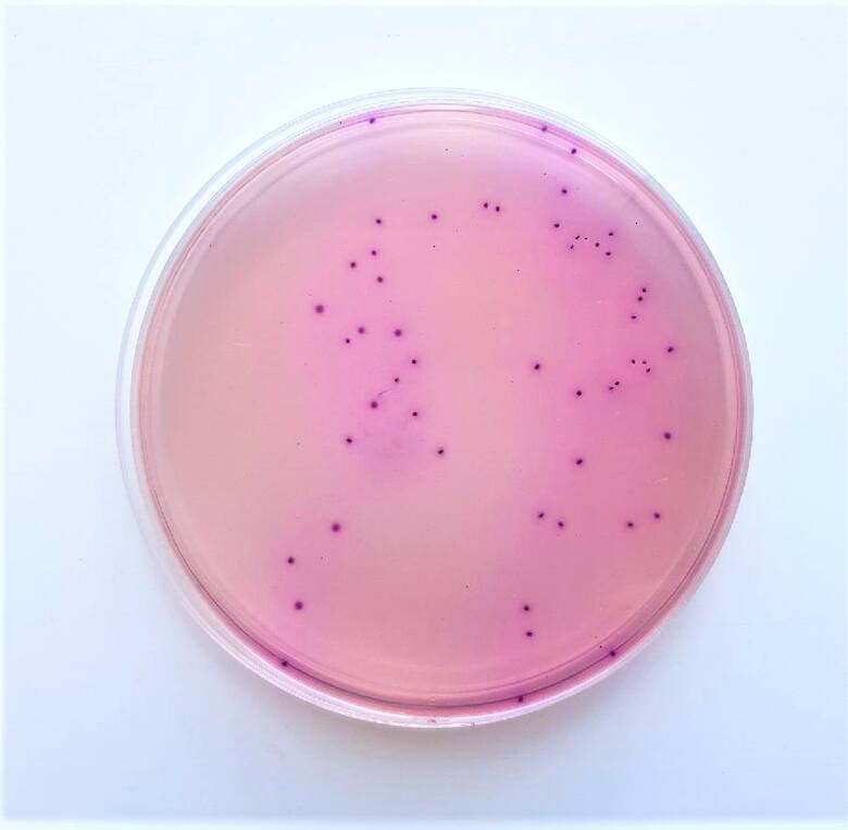 Badania laboratoryjne wykazały pojawienie się bakterii w 10 pobranych próbkach.