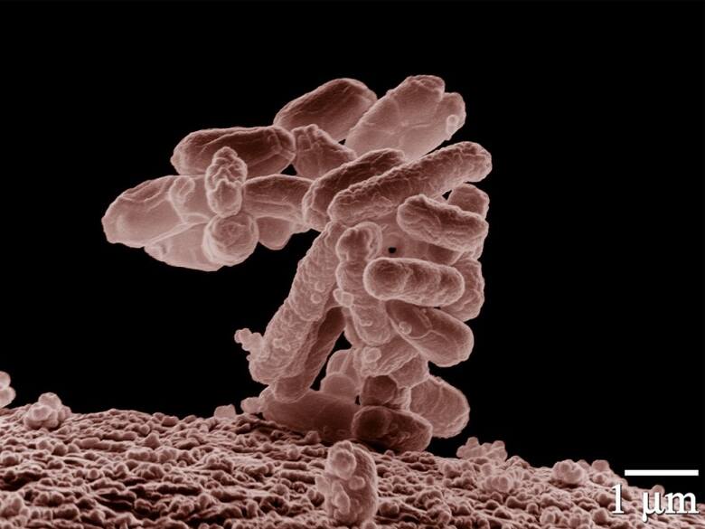 Skupisko E. coli powiększone 10.000 x