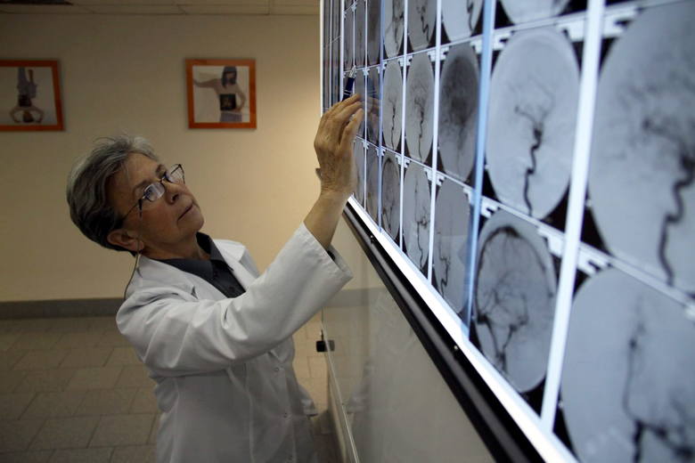 Najlepiej w Polsce leczą udary mózgu