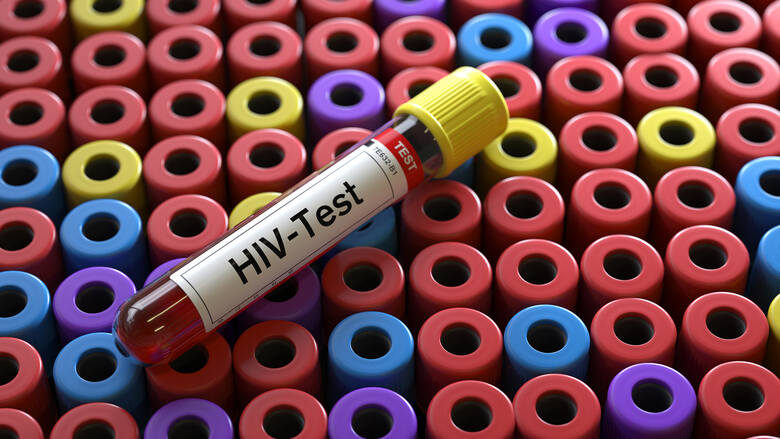 Próbówka z krwią do testu na HIV