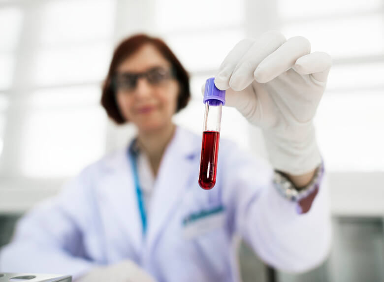 Laborantka bada CRP z krwi