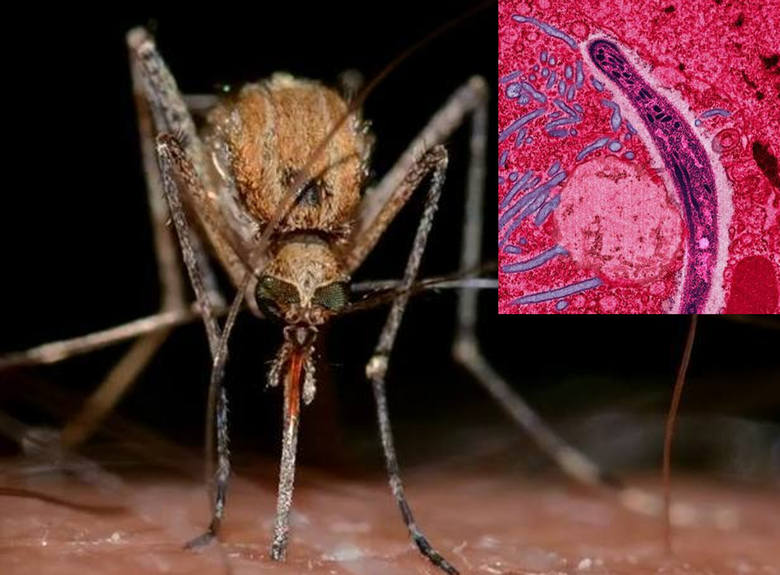 Malaria. Ostra lub przewlekła, tropikalna choroba pasożytnicza, która jest przenoszona przez samice komarów z rodzaju Anopheles. Jest to najczęstsza