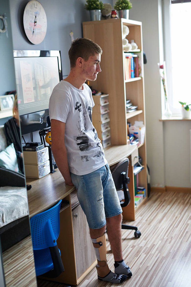 Bez tej protezy nie da się normalnie żyć. Pomóżmy 16-letniemu Kacprowi ze Skierniewic spełnić jego marzenie!