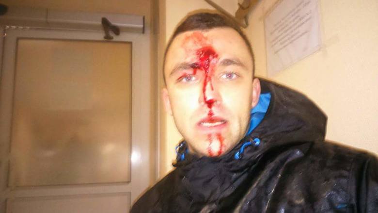 Policjant wymierzył i strzelił mu prosto między oczy