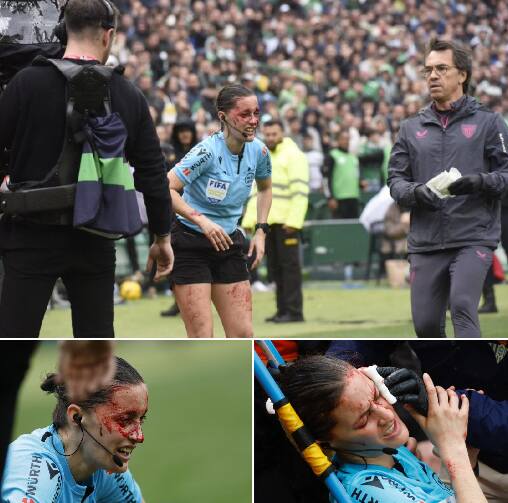 Sędzia zalana krwią. Asystent arbitra zderzyła się z kamerą telewizyjną i rozcięła głowę podczas meczu LaLiga Betis – Athletic Bilbao