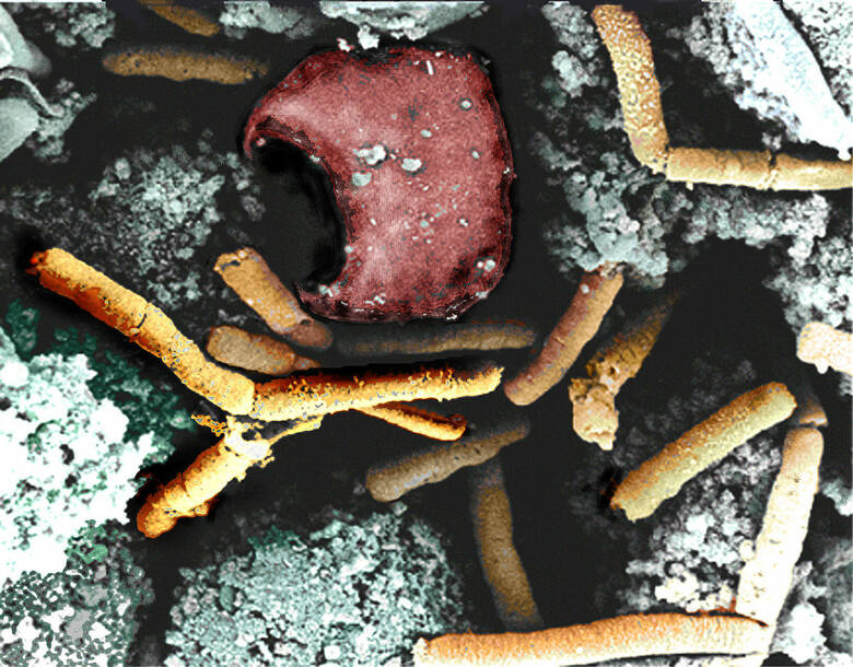 Pokolorowane zdjęcie z mikroskopu elektronowego śledziony małpy chorej na wąglik płucny; widoczne odkryte przez Kocha laseczki wąglika (żółte) i erytrocyty