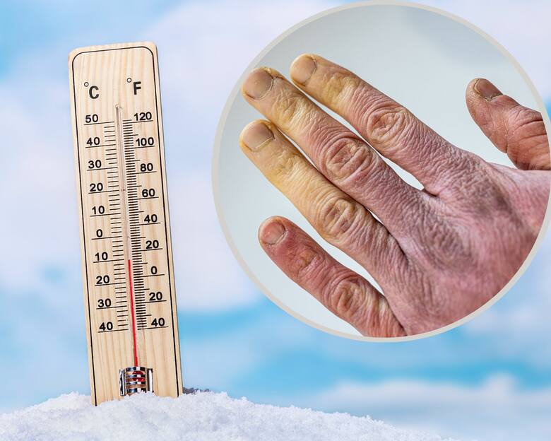 Temperatura poniżej minus 10 na termometrze i odmrożone dłonie