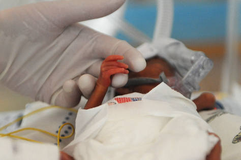 Najmniejszy noworodek w historii ważył po urodzeniu zaledwie 440 gramów