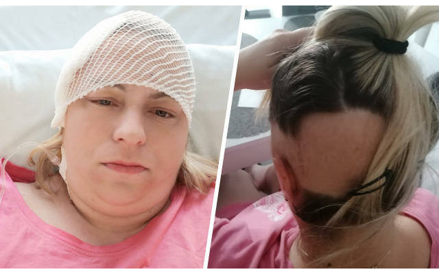 Agnieszka Brzeczek przeszła trzy operacje, wciąż ma dużo siły, by walczyć, ale nie ma pieniędzy.