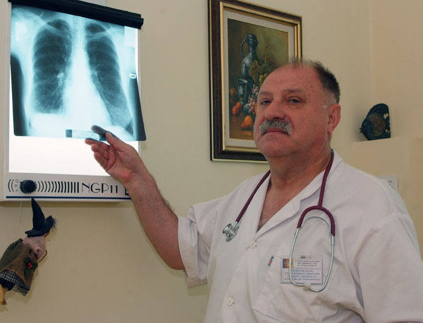 Prześwietlenie płuc wykazuje niepokojące zmiany chorobowe. Nz. dr Andrzej Michalski z Centrum Leczenia Chorób Płuc w Łagiewnikach.<br>