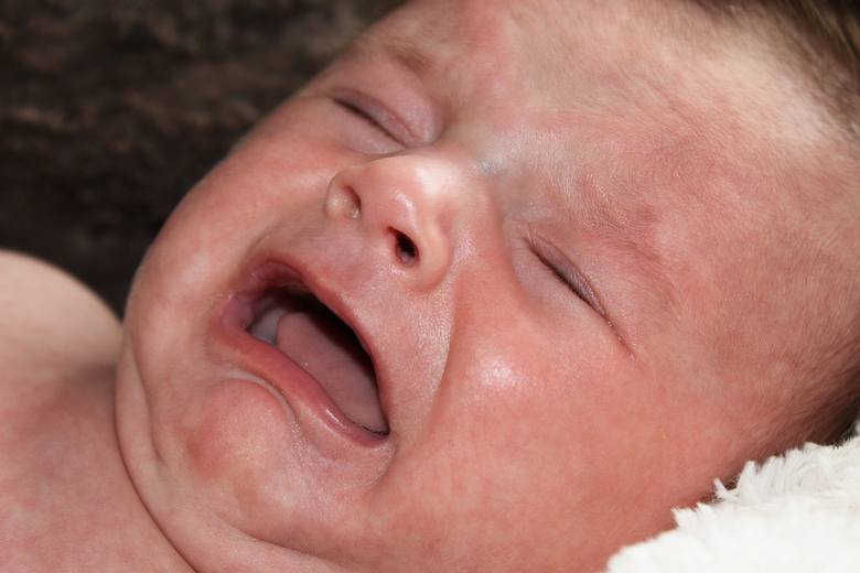Jeśli u niemowlęcia występuje nietolerancja laktozy, zwykle związana jest ona z przebytą infekcją, zakażeniem układu pokarmowego, celiakią albo alergią