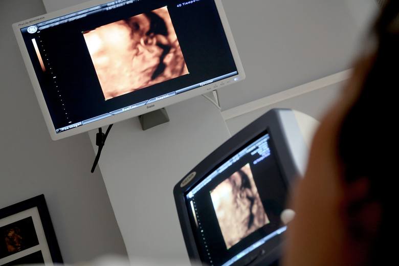 <strong>USG</strong><br /> Badanie potwierdzi ciążę i może monitorować płód w różnych momentach rozwoju. Badanie USG jest bardzo dokładne, dlatego za jego pomocą lekarz jest w stanie wykryć nawet niewielkie zmiany w narządach człowieka. <br /> <br /> <strong>Ile kosztuje badanie?<br /> </strong>Szpital Praski w...