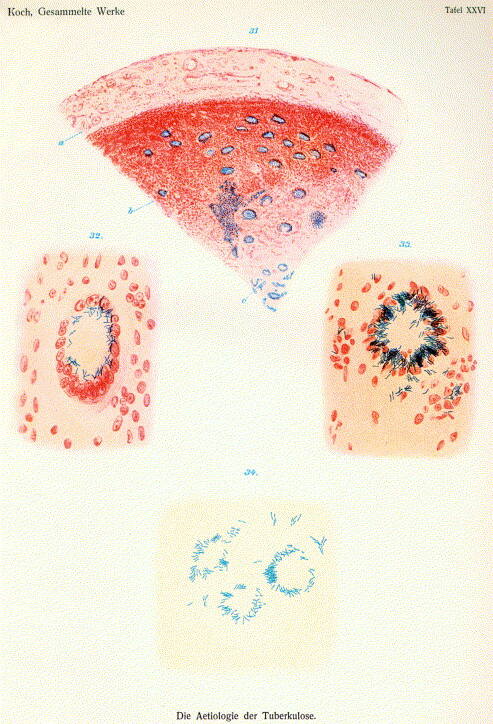 Rysunek Roberta Kocha, który opisał odkryte przez siebie bakterie gruźlicy w 1882 r.