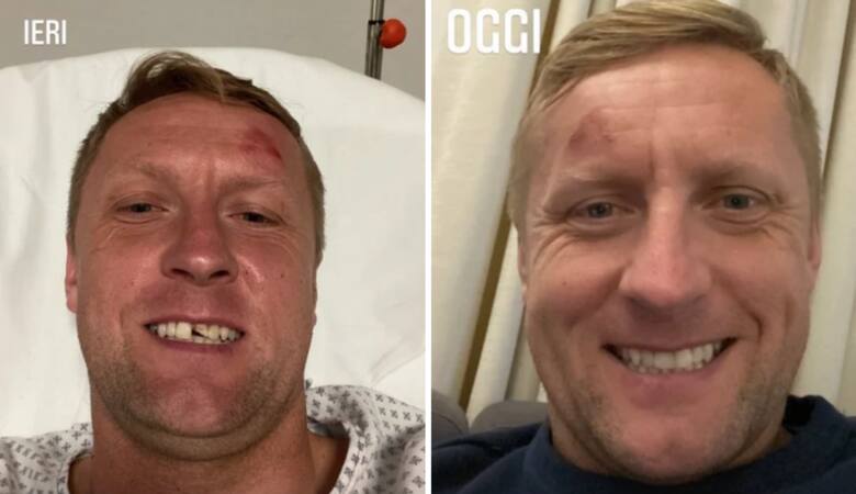 Kamil Glik stracił zęby. Opublikował selfie przed i po wizycie u stomatologa [ZDJĘCIA]