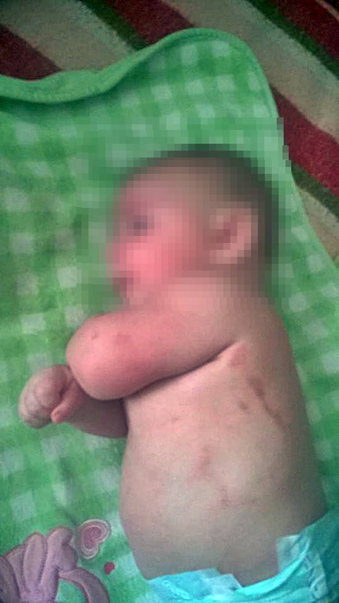 Podejrzenie siniaki u niemowlęcia w Stargardzie. Trzymiesięczny chłopczyk trafił do szpitala