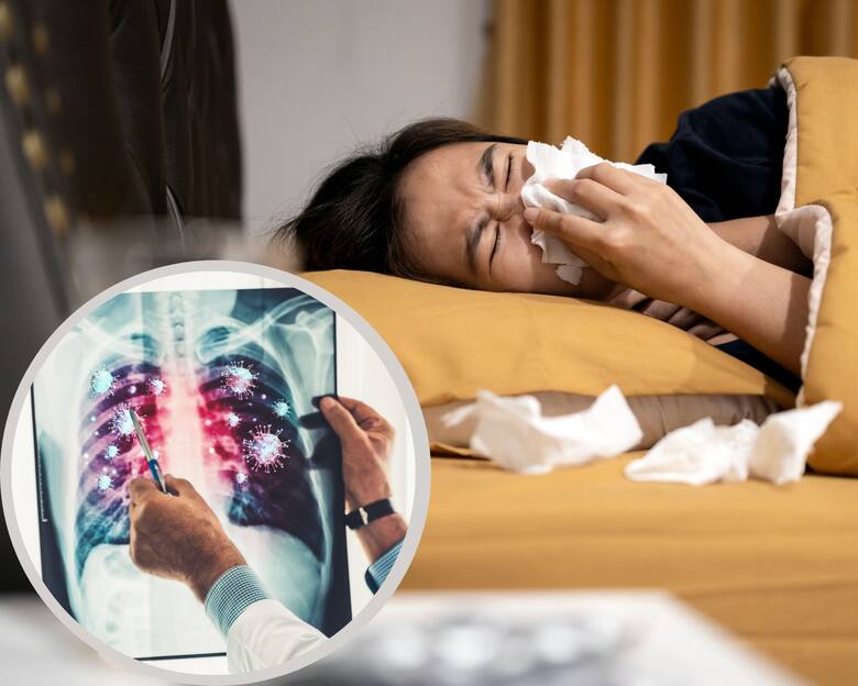 Młoda kobieta z katarem i koronawirus w układzie oddechowym