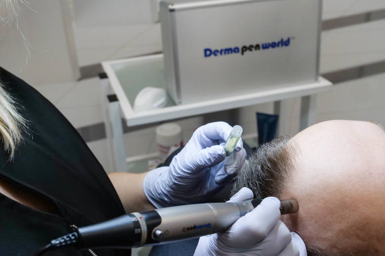 Kosmetologia laserowa i estetyczna dla mężczyzn w nowoczesnej klinice Laser Clinic w Kielcach. Szeroka gama zabiegów, gwarantowane efekty