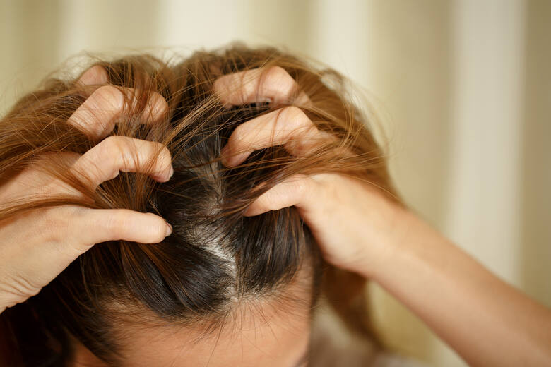 Młoda kobieta rozgarnia włosy i drapie palcami skórę głowy