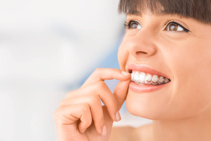 Aparat ortodontyczny - fakty i mity na temat leczenia wad zgryzu