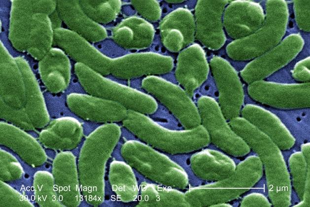 „Vibrio vulnificus”/Otrzymane z biblioteki obrazów CDC Public Health