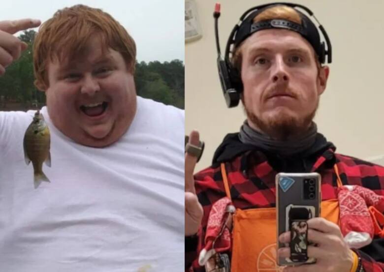 Casey King przed utratą wagi oraz po utracie ponad 260 kiliogramów