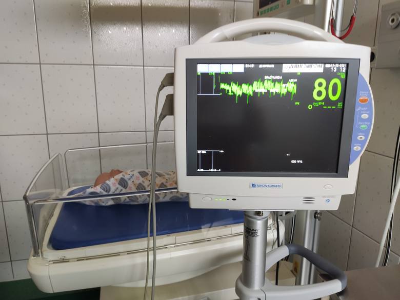 Sala porodowa - kardiomonitor, stanowisko do resuscytacji noworodka