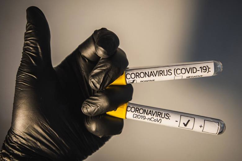 Na Opolszczyźnie wciąż wykonuje się najmniej testów na koronawirusa w Polsce!