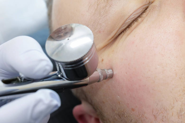 Kosmetologia laserowa i estetyczna dla mężczyzn w nowoczesnej klinice Laser Clinic w Kielcach. Szeroka gama zabiegów, gwarantowane efekty