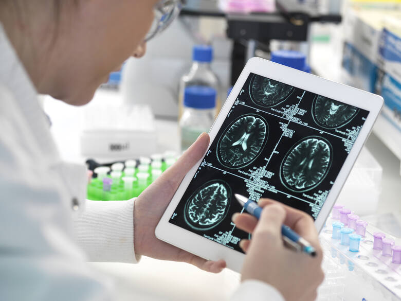 Lekarz przeglądający skan mózgu pacjenta na cyfrowym tablecie w laboratorium