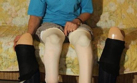 Elżbieta Gorgoń nigdy nie robiła tragedii z tego powodu, że straciła nogi, wiedziała, że musi być silna i nie pozwalała sobie na załamanie. Stare protezy