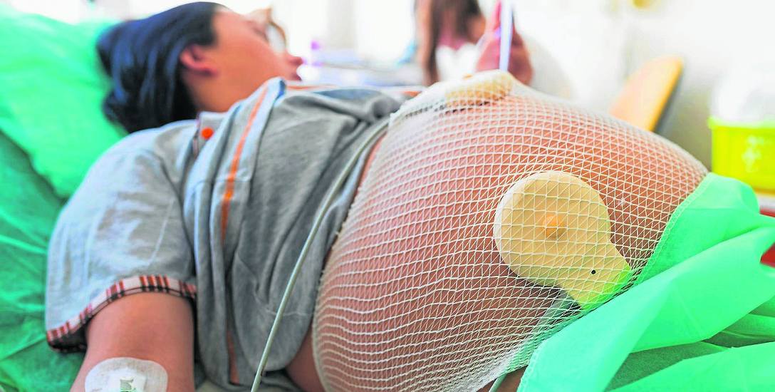 Postęp medycyny przyczynił się do wykrywania nieprawidłowości w przebiegu ciąży i zwiększenia liczby cięć cesarskich