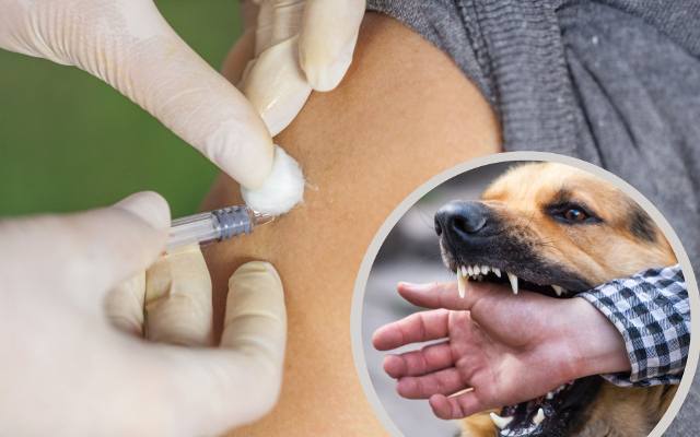 Co robić, gdy ugryzie cię nieszczepiony pies lub dzikie zwierzę? Ta choroba zabija, ratuj swoje życie! Takie są objawy wścieklizny u ludzi