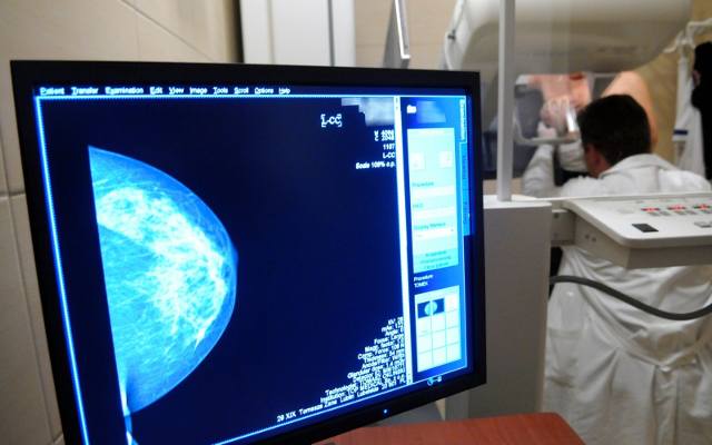 Bezpłatna mammografia w Poznaniu: Coraz mniej kobiet w Wielkopolsce korzysta z bezpłatnych badań piersi 