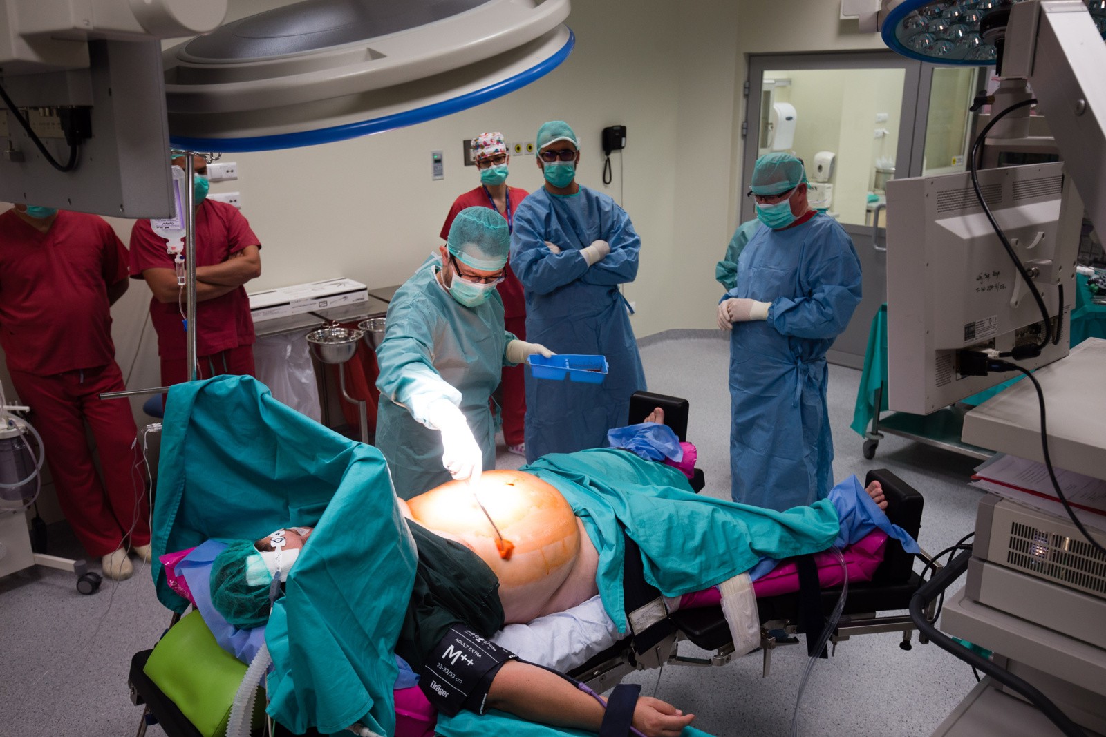 Operacja Bariatryczna Zmniejszenia żołądka W Szpitalu Wojewódzkim W Białymstoku Zdjęcia 6186