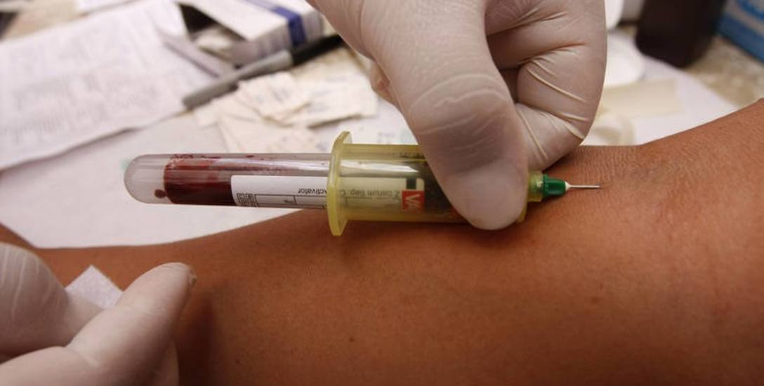 Test w kierunku HIV polega na pobraniu niewielkiej próbki krwi