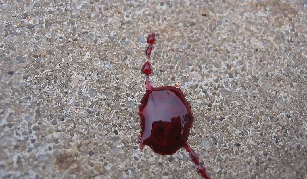 Chorzowianka leżała kilkanaście minut w kałuży krwi. Nikt jej nie pomógł