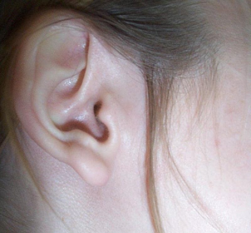 Jak nazywają się trzy kosteczki słuchowe?